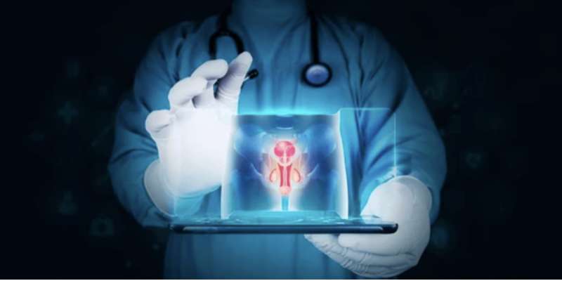 Varikosel Nedir? Varikosel Belirtileri Nelerdir? Varikoselektomi Nedir ve Nasıl Yapılır?