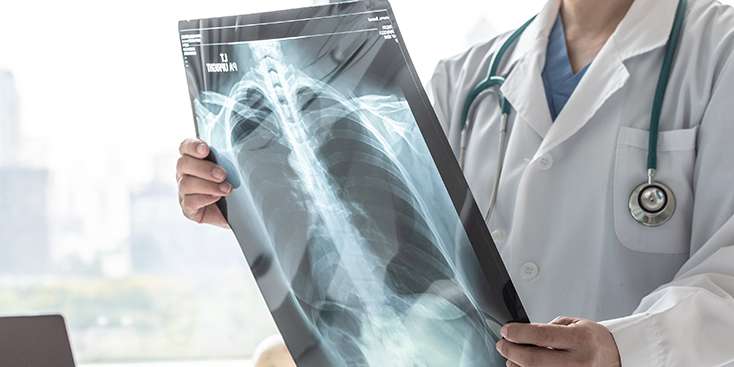 KOAH Patofizyoloji Nedir?