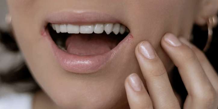 Aft Nedir? Aft Neden Olur ve Soğuk Havalarda Neden Artar?